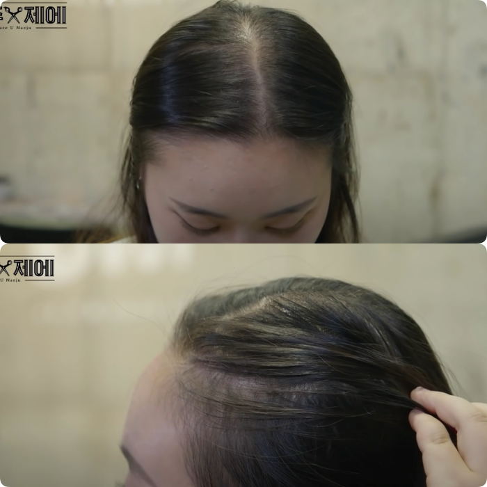Hair stylist người Hàn bày cách "cứu rỗi" mái tóc mỏng dính lộ cả mảng ra đầu: Chị em tự làm ở nhà ngon ơ mà chẳng cần ra tiệm - Ảnh 1. Hair stylist người Hàn bày cách "cứu rỗi" mái tóc mỏng dính lộ cả mảng ra đầu: Chị em tự làm ở nhà ngon ơ mà chẳng cần ra tiệm - Ảnh 1.