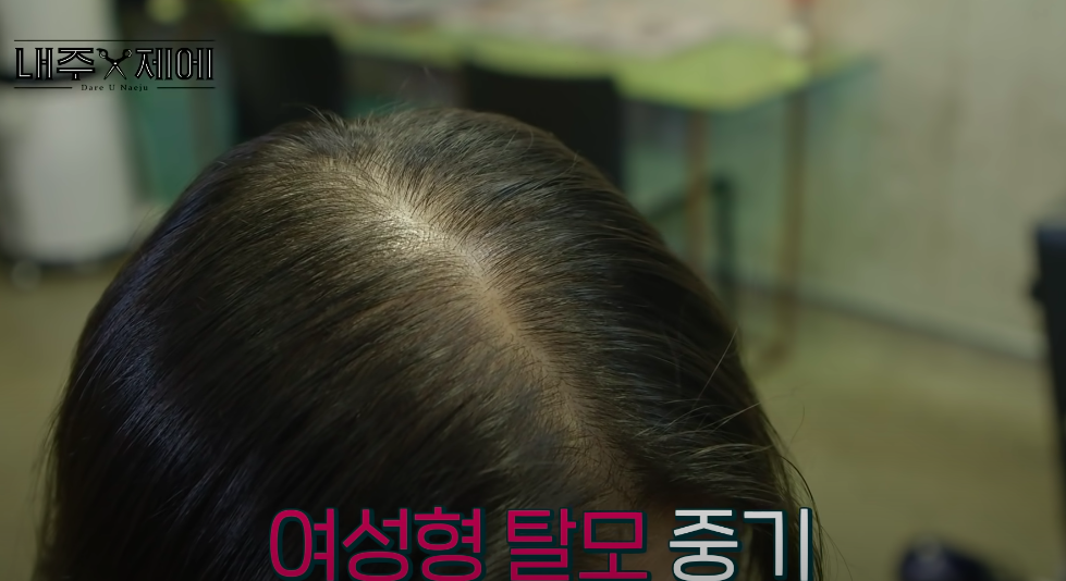 Hair stylist người Hàn bày cách "cứu rỗi" mái tóc mỏng dính lộ cả mảng ra đầu: Chị em tự làm ở nhà ngon ơ mà chẳng cần ra tiệm - Ảnh 2. Hair stylist người Hàn bày cách "cứu rỗi" mái tóc mỏng dính lộ cả mảng ra đầu: Chị em tự làm ở nhà ngon ơ mà chẳng cần ra tiệm - Ảnh 2.