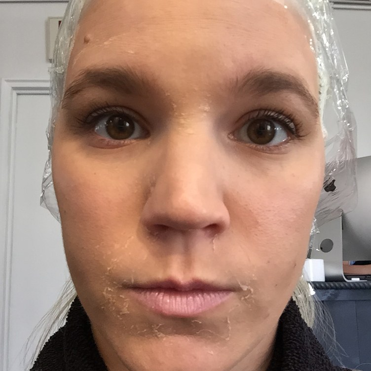 Cô nàng dùng thử loại gel dán mụn thần thánh suốt thời gian qua và đây là kết quả - Ảnh 12. Cô nàng dùng thử loại gel dán mụn thần thánh suốt thời gian qua và đây là kết quả - Ảnh 12.