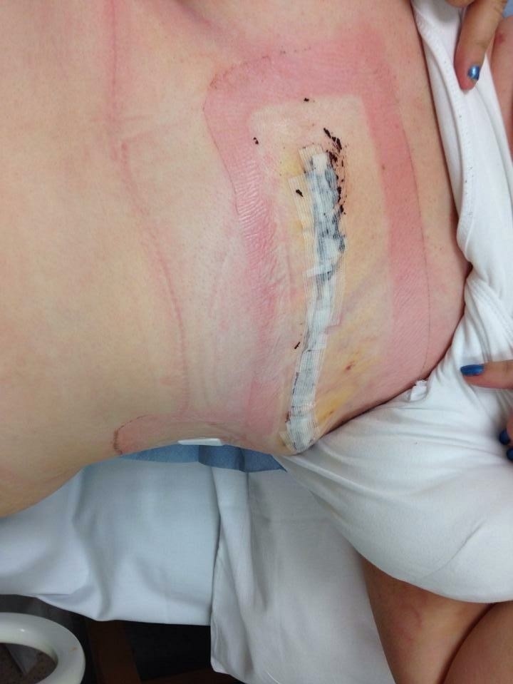 Vừa kết hôn đã phải cắt bỏ ngực, cuộc sống với một bên ngực của tôi không dễ dàng nhưng đầy tự hào - Ảnh 3. Vừa kết hôn đã phải cắt bỏ ngực, cuộc sống với một bên ngực của tôi không dễ dàng nhưng đầy tự hào - Ảnh 3.