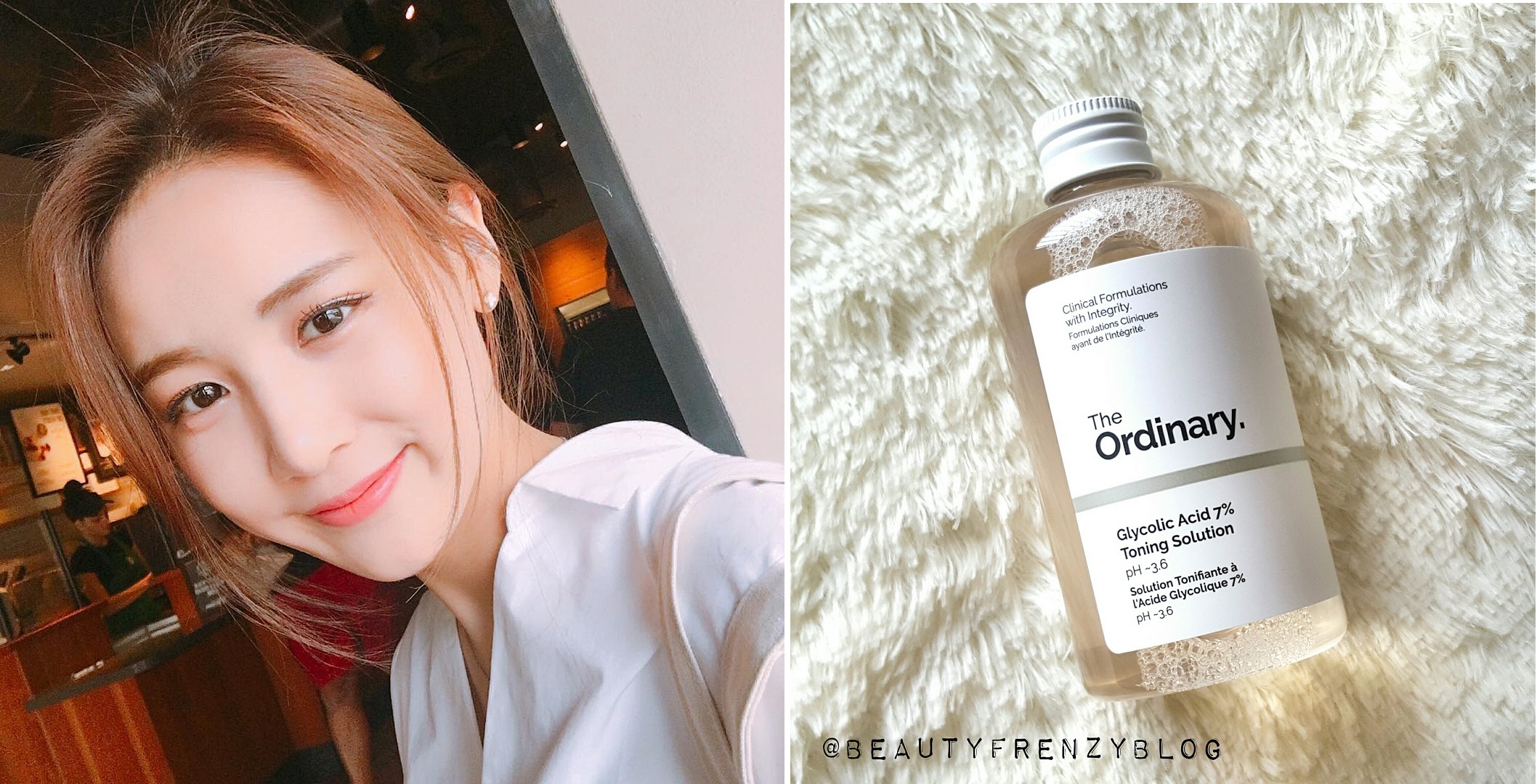 Nếu muốn làm trẻ hóa da với acid, thì đây là những loại cơ bản mà bạn cần biết - Ảnh 2. Nếu muốn làm trẻ hóa da với acid, thì đây là những loại cơ bản mà bạn cần biết - Ảnh 2.