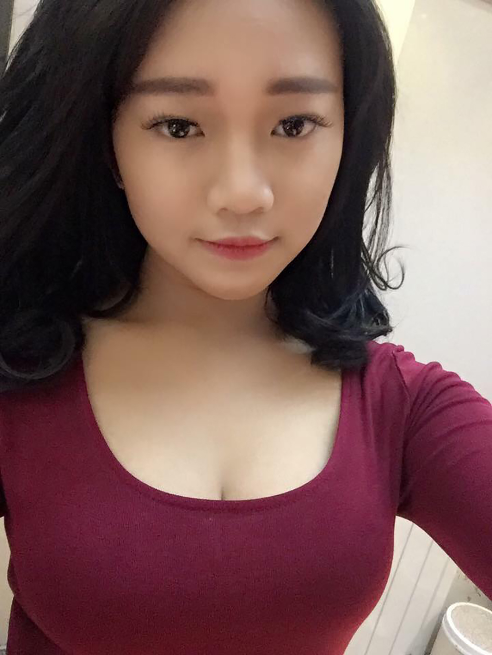 Muốn làm duyên bằng má lúm đồng tiền nhân tạo, cô gái trẻ bị áp-xe, má sưng như quả trứng - Ảnh 2. Muốn làm duyên bằng má lúm đồng tiền nhân tạo, cô gái trẻ bị áp-xe, má sưng như quả trứng - Ảnh 2.