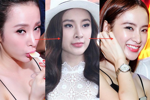 Tháo sụn mũi đơn giản thế này, chẳng trách HH Đại Dương và nhiều người đẹp Việt lại sở hữu chiếc mũi mỗi ngày - Ảnh 5. Tháo sụn mũi đơn giản thế này, chẳng trách HH Đại Dương và nhiều người đẹp Việt lại sở hữu chiếc mũi mỗi ngày - Ảnh 5.