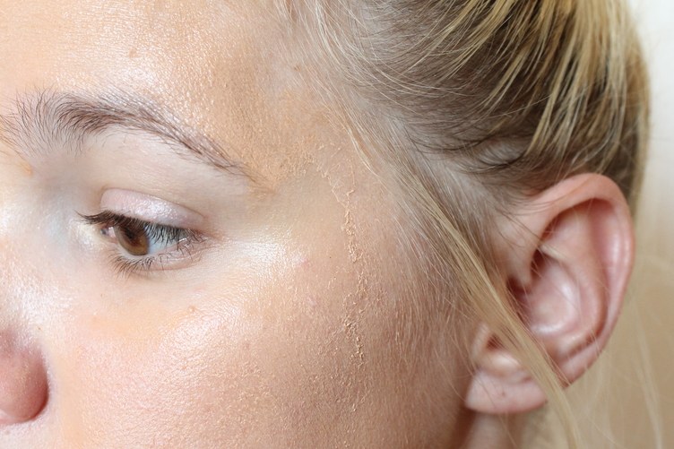 Cô nàng dùng thử loại gel dán mụn thần thánh suốt thời gian qua và đây là kết quả - Ảnh 8. Cô nàng dùng thử loại gel dán mụn thần thánh suốt thời gian qua và đây là kết quả - Ảnh 8.