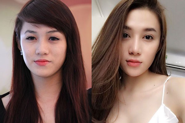 Tháo sụn mũi đơn giản thế này, chẳng trách HH Đại Dương và nhiều người đẹp Việt lại sở hữu chiếc mũi mỗi ngày - Ảnh 9. Tháo sụn mũi đơn giản thế này, chẳng trách HH Đại Dương và nhiều người đẹp Việt lại sở hữu chiếc mũi mỗi ngày - Ảnh 9.