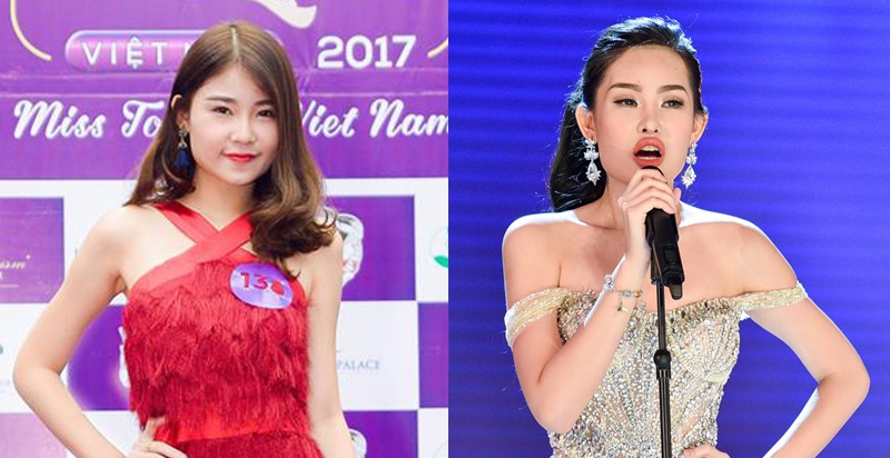 Thừa nhận đã tháo mũi giả, nhưng còn đôi môi căng phồng khác lạ của HH Ngân Anh tại đêm chung kết thì sao! - Ảnh 9. Thừa nhận đã tháo mũi giả, nhưng còn đôi môi căng phồng khác lạ của HH Ngân Anh tại đêm chung kết thì sao! - Ảnh 9.