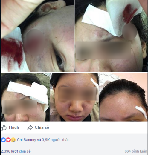 '. Hà Nội: Người vợ xinh đẹp “tố” bị chồng đánh rách đầu ngay cả khi mang bầu .'