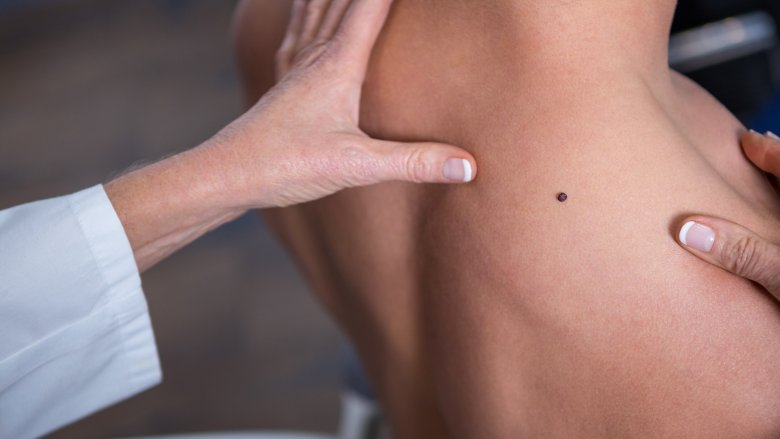 9 dấu hiệu cảnh báo bệnh từ cơ thể các chuyên gia khuyên bạn không bao giờ được bỏ qua - Ảnh 7. 9 dấu hiệu cảnh báo bệnh từ cơ thể các chuyên gia khuyên bạn không bao giờ được bỏ qua - Ảnh 7.