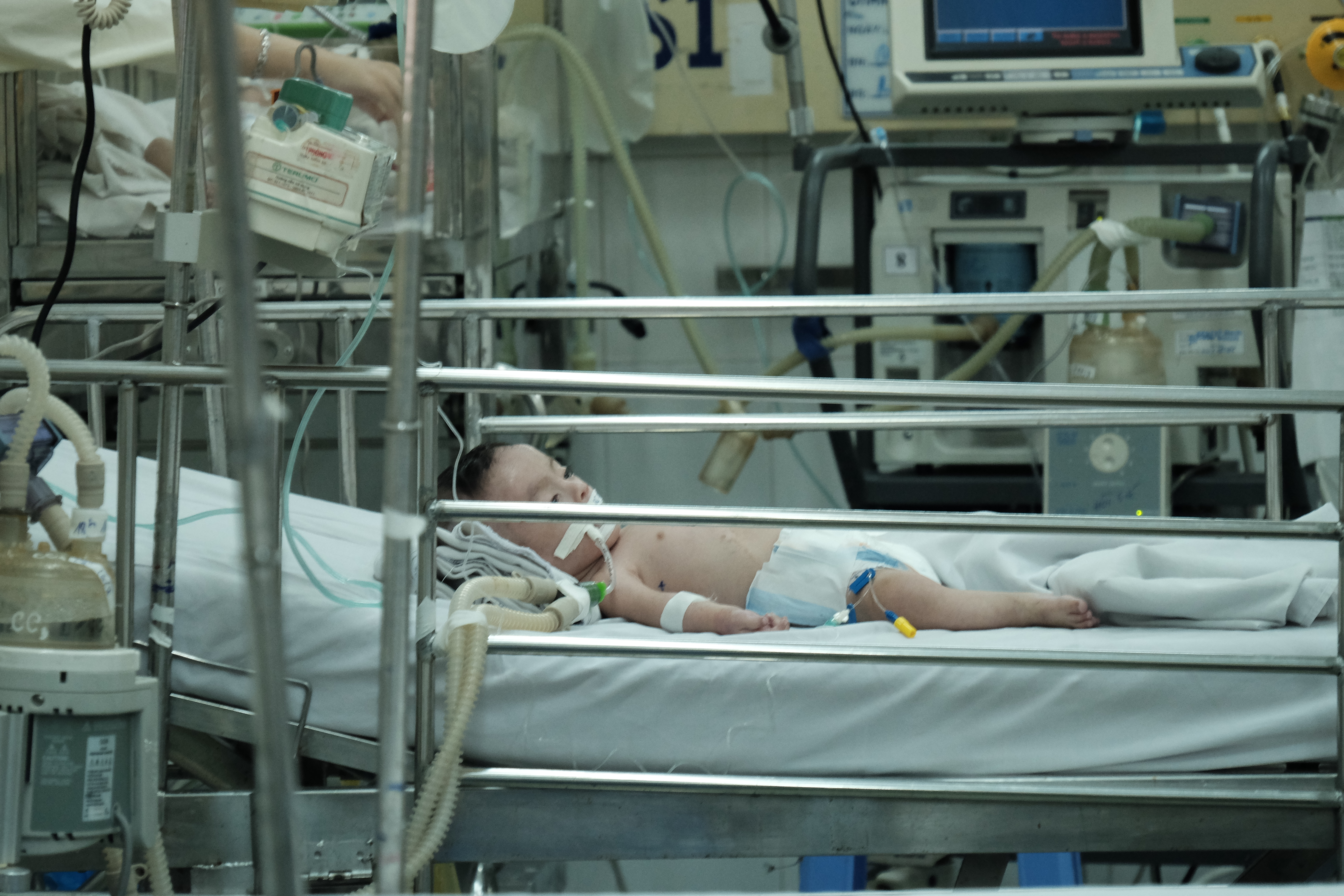 Vắt chanh vào miệng khi trẻ lên cơn co giật, mẹ suýt giết con vì sai lầm chết người - Ảnh 4. Vắt chanh vào miệng khi trẻ lên cơn co giật, mẹ suýt giết con vì sai lầm chết người - Ảnh 4.
