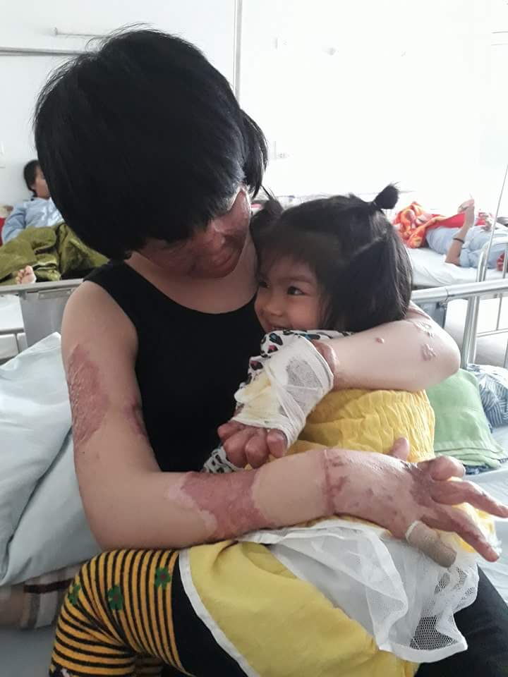 Cô gái bị chồng thiêu sống đúng mùng 2 Tết năm ngoái vẫn đang trên hành trình tìm lại hình hài - Ảnh 9. Cô gái bị chồng thiêu sống đúng mùng 2 Tết năm ngoái vẫn đang trên hành trình tìm lại hình hài - Ảnh 9.