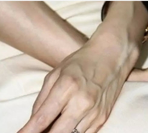 Phụ nữ chớ nên coi thường việc nổi gân xanh trên cơ thể, nhất là trên chân - Ảnh 1.