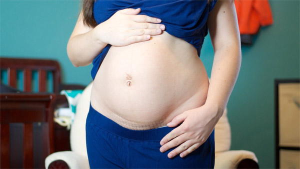 Những điều cần biết dành cho mẹ muốn sinh thường sau khi đã từng sinh mổ - Ảnh 1.