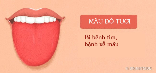 Bằng cách kiểm tra lưỡi mỗi ngày, rất có thể bạn sẽ phát hiện sớm những căn bệnh mình đang gặp phải - Ảnh 8.