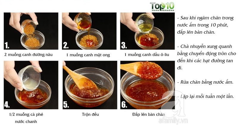 7 phương pháp hàng đầu giúp bạn không bị nhiễm trùng và nứt gót chân trong mùa đông này - Ảnh 5. 7 phương pháp hàng đầu giúp bạn không bị nhiễm trùng và nứt gót chân trong mùa đông này - Ảnh 5.