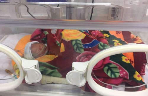 Thật kì diệu: Một bà mẹ ở Nghệ An sinh con vẫn cuộn tròn trong túi ối - Ảnh 3.