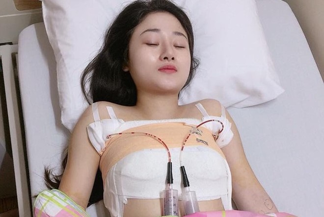 9X tốn gần 60 triệu đồng nâng cấp vòng một chảy xệ sau sinh - Ảnh 1. 9X tốn gần 60 triệu đồng nâng cấp vòng một chảy xệ sau sinh - Ảnh 1.