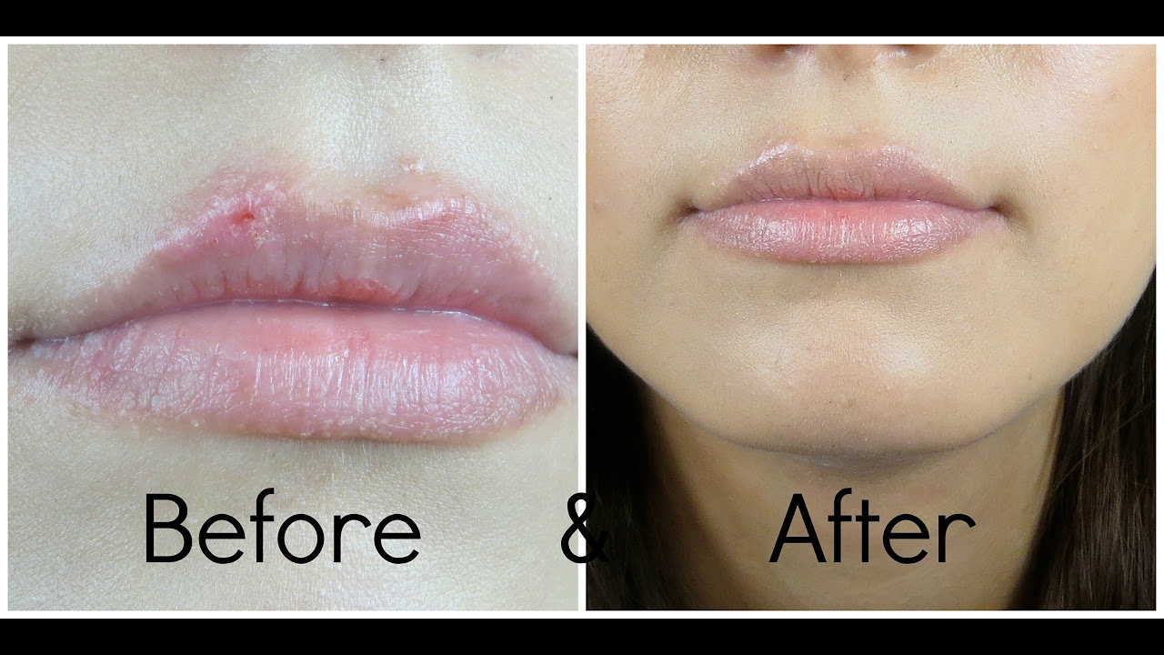 5 mẹo làm đẹp nức tiếng mạng xã hội nhưng các chuyên gia đều lắc đầu phản đối - Ảnh 4. 5 mẹo làm đẹp nức tiếng mạng xã hội nhưng các chuyên gia đều lắc đầu phản đối - Ảnh 4.