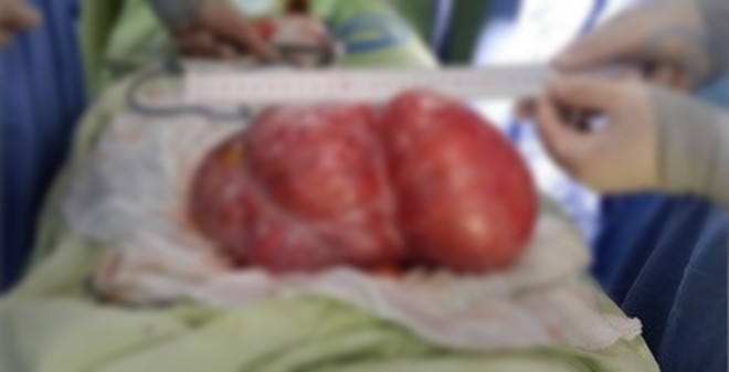 Clip tế bào ung thư gặp vàng thì tới, gặp tỏi thì chạy là hoàn toàn giả mạo - Ảnh 2. Clip tế bào ung thư gặp vàng thì tới, gặp tỏi thì chạy là hoàn toàn giả mạo - Ảnh 2.
