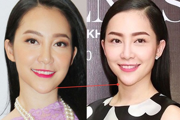 Sau những lần xuất hiện với chiếc cằm khác thường, nhan sắc của Linh Nga hiện giờ thế nào - Ảnh 5.