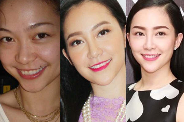 Sau những lần xuất hiện với chiếc cằm khác thường, nhan sắc của Linh Nga hiện giờ thế nào - Ảnh 6.