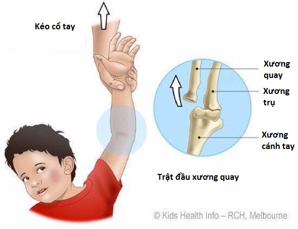 Bố mẹ nào con chơi trò chơi này với con thì làm ơn ngừng ngay lập tức! - Ảnh 2.