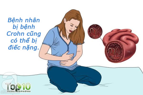 8 bệnh tưởng chừng không liên quan đến tai nhưng lại có thể gây kích thích tai, thậm chí khiến bạn bị điếc vĩnh viễn - Ảnh 5.