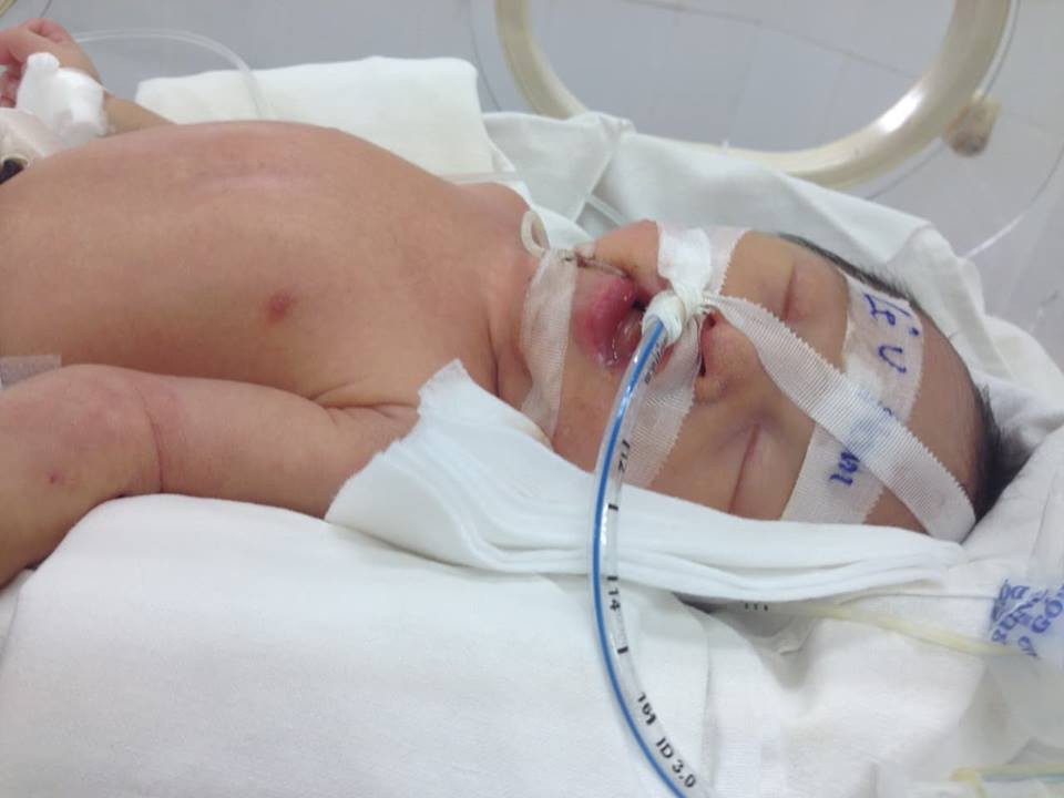Hành trình hồi phục kì diệu của cặp song sinh chào đời chỉ nặng 1.7kg, trải qua 3 lần cấp cứu tưởng không qua khỏi - Ảnh 4. Hành trình hồi phục kì diệu của cặp song sinh chào đời chỉ nặng 1.7kg, trải qua 3 lần cấp cứu tưởng không qua khỏi - Ảnh 4.