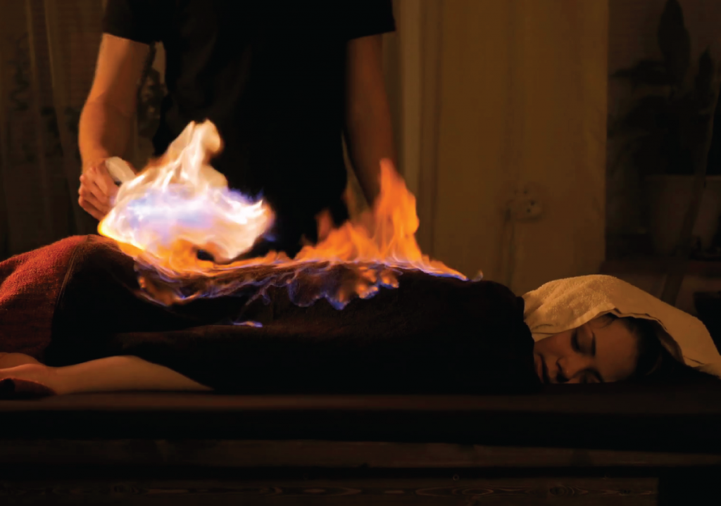 Hỏa trị liệu giúp chữa bệnh, làm đẹp và giảm cân: Có thực sự thần kỳ như nhiều người đang nghĩ? - Ảnh 3. Hỏa trị liệu giúp chữa bệnh, làm đẹp và giảm cân: Có thực sự thần kỳ như nhiều người đang nghĩ? - Ảnh 3.