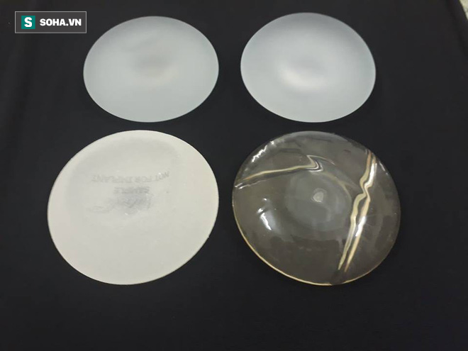 Vụ ca sĩ Ivy Trần nổ ngực trên máy bay: Bác sĩ thẩm mỹ lý giải nguyên nhân thực tế - Ảnh 2. Vụ ca sĩ Ivy Trần nổ ngực trên máy bay: Bác sĩ thẩm mỹ lý giải nguyên nhân thực tế - Ảnh 2.