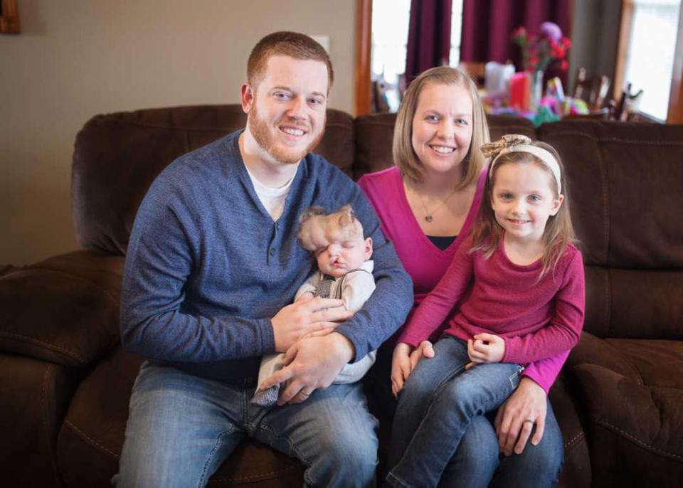 Sinh ra không có hộp sọ, cứ tưởng bé trai này sẽ không qua khỏi, nhưng rồi kỳ tích đã xảy ra - Ảnh 2. Sinh ra không có hộp sọ, cứ tưởng bé trai này sẽ không qua khỏi, nhưng rồi kỳ tích đã xảy ra - Ảnh 2.