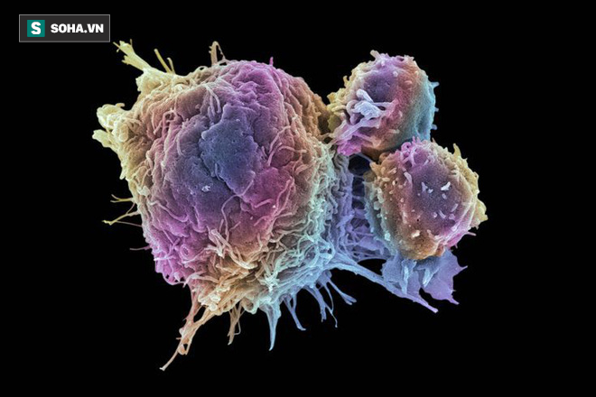 Mầm ung thư ẩn náu ở 7 loại thực phẩm: Nếu không muốn mắc bệnh, bạn nên đặc biệt chú ý! - Ảnh 1. Mầm ung thư ẩn náu ở 7 loại thực phẩm: Nếu không muốn mắc bệnh, bạn nên đặc biệt chú ý! - Ảnh 1.