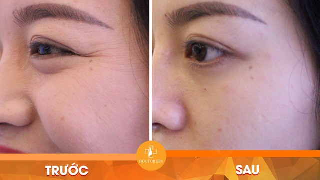 Cơ hội trải nghiệm công nghệ “cải lão hoàn đồng” do bàn tay vàng Châu Á Hyunji Lim trực tiếp thực hiện - Ảnh 6. Cơ hội trải nghiệm công nghệ “cải lão hoàn đồng” do bàn tay vàng Châu Á Hyunji Lim trực tiếp thực hiện - Ảnh 6.