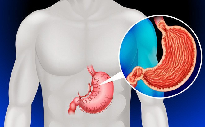 Đây là 6 căn bệnh ung thư mà người thừa cân có nguy cơ mắc phải rất cao - Ảnh 4. Đây là 6 căn bệnh ung thư mà người thừa cân có nguy cơ mắc phải rất cao - Ảnh 4.