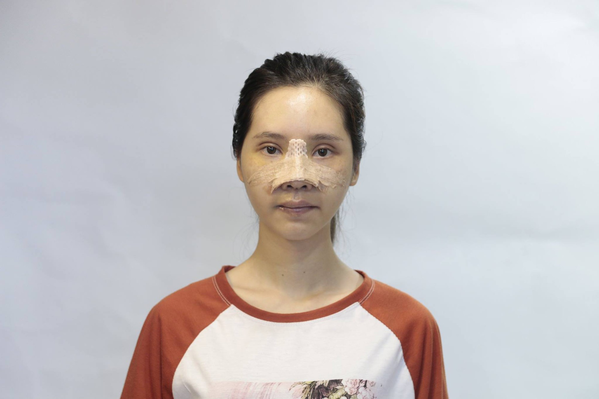 Mặt xấu xí như vậy chỉ đem lại vận xui - lời từ chối khi xin việc và màn lột xác ngoạn mục của cô gái trẻ khiến bao người ngỡ ngàng - Ảnh 4. Mặt xấu xí như vậy chỉ đem lại vận xui - lời từ chối khi xin việc và màn lột xác ngoạn mục của cô gái trẻ khiến bao người ngỡ ngàng - Ảnh 4.