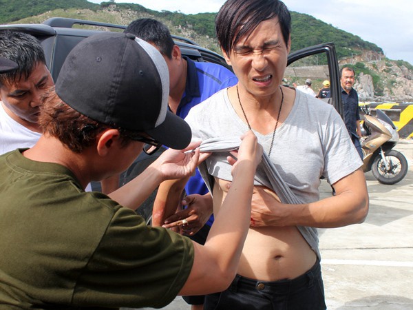 Sao Việt v&agrave; những lần gặp tai nạn nghi&ecirc;m trọng: G&atilde;y xương, suy giảm thị lực nhưng vẫn chưa phải điều kinh khủng nhất - Ảnh 7.