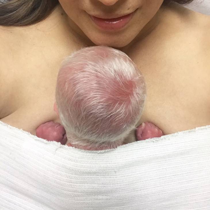 Sinh con có mái tóc trắng như cước, mẹ hí hửng đi khoe, không ngờ con mắc bệnh nguy hiểm - Ảnh 2. Sinh con có mái tóc trắng như cước, mẹ hí hửng đi khoe, không ngờ con mắc bệnh nguy hiểm - Ảnh 2.