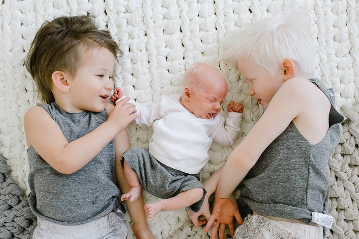 Sinh con có mái tóc trắng như cước, mẹ hí hửng đi khoe, không ngờ con mắc bệnh nguy hiểm - Ảnh 10. Sinh con có mái tóc trắng như cước, mẹ hí hửng đi khoe, không ngờ con mắc bệnh nguy hiểm - Ảnh 10.
