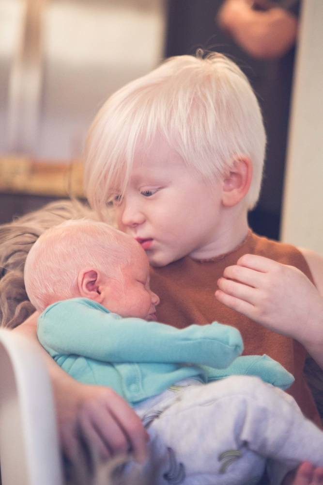Sinh con có mái tóc trắng như cước, mẹ hí hửng đi khoe, không ngờ con mắc bệnh nguy hiểm - Ảnh 11. Sinh con có mái tóc trắng như cước, mẹ hí hửng đi khoe, không ngờ con mắc bệnh nguy hiểm - Ảnh 11.