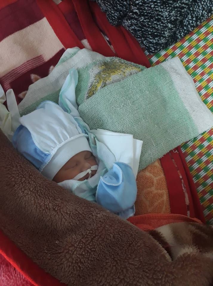 Bị đa ối, thai nhi tắc ruột, bác sĩ khuyên đình chỉ thai nhưng mẹ vẫn quyết sinh con và điều này đã đến - Ảnh 3. Bị đa ối, thai nhi tắc ruột, bác sĩ khuyên đình chỉ thai nhưng mẹ vẫn quyết sinh con và điều này đã đến - Ảnh 3.