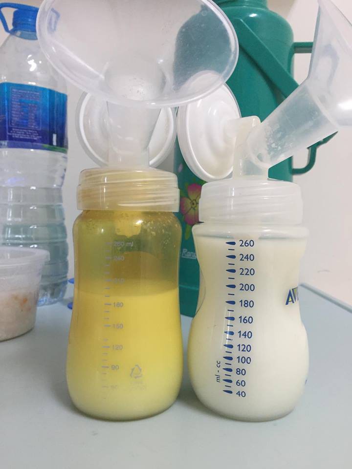 Mới 11 tháng tuổi, bé gái ú na ú nần đã nặng 14kg khiến các mẹ không thể tin vào mắt mình - Ảnh 9. Mới 11 tháng tuổi, bé gái ú na ú nần đã nặng 14kg khiến các mẹ không thể tin vào mắt mình - Ảnh 9.