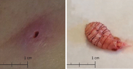 7 ca b&ecirc;̣nh g&acirc;y chấn động nhất năm 2018 nghe chừng tưởng như chỉ c&oacute; trong phim kinh dị  - Ảnh 3.