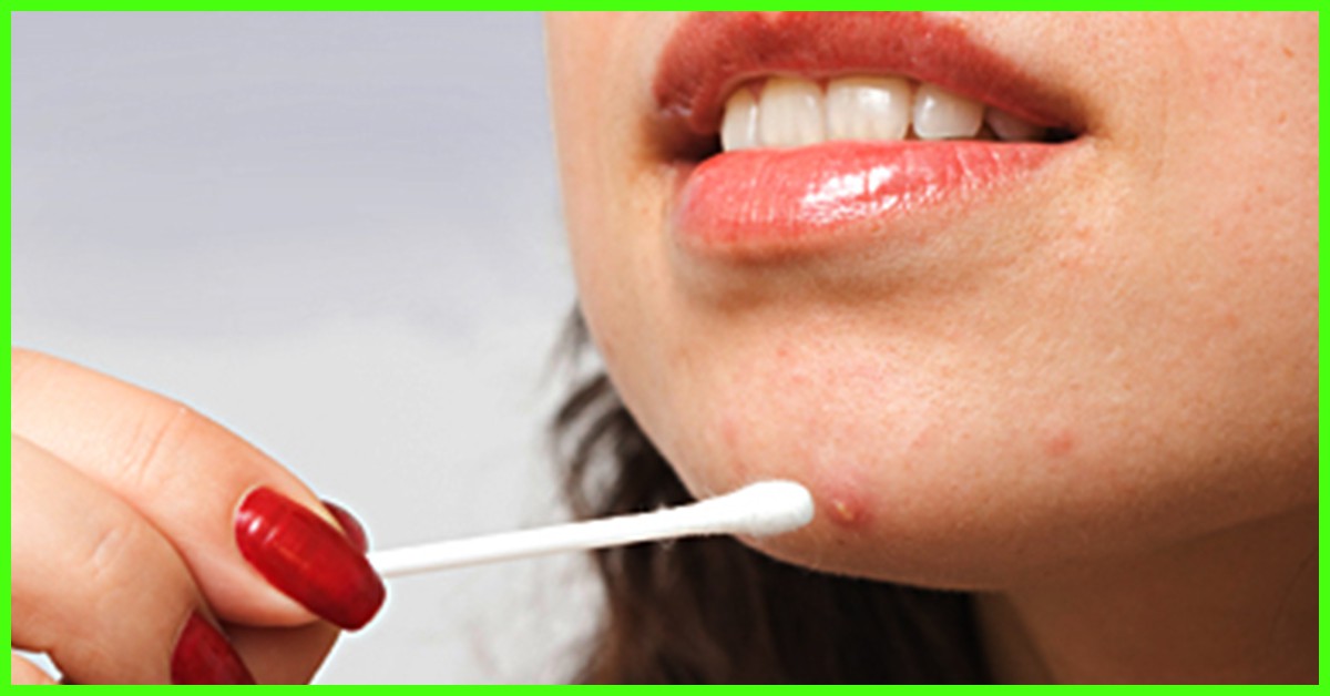 Ngày nghỉ lễ cũng không lo bị bệnh nhờ những cách chữa bệnh tự nhiên từ nguyên liệu có sẵn ngay trong bếp - Ảnh 2. Ngày nghỉ lễ cũng không lo bị bệnh nhờ những cách chữa bệnh tự nhiên từ nguyên liệu có sẵn ngay trong bếp - Ảnh 2.
