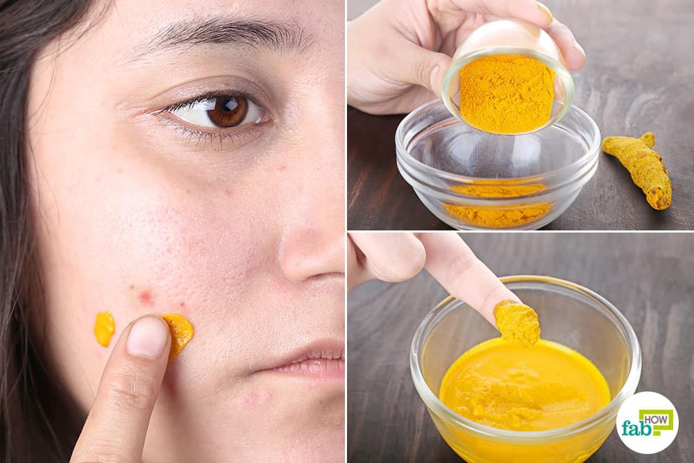 Ngày nghỉ lễ cũng không lo bị bệnh nhờ những cách chữa bệnh tự nhiên từ nguyên liệu có sẵn ngay trong bếp - Ảnh 7. Ngày nghỉ lễ cũng không lo bị bệnh nhờ những cách chữa bệnh tự nhiên từ nguyên liệu có sẵn ngay trong bếp - Ảnh 7.