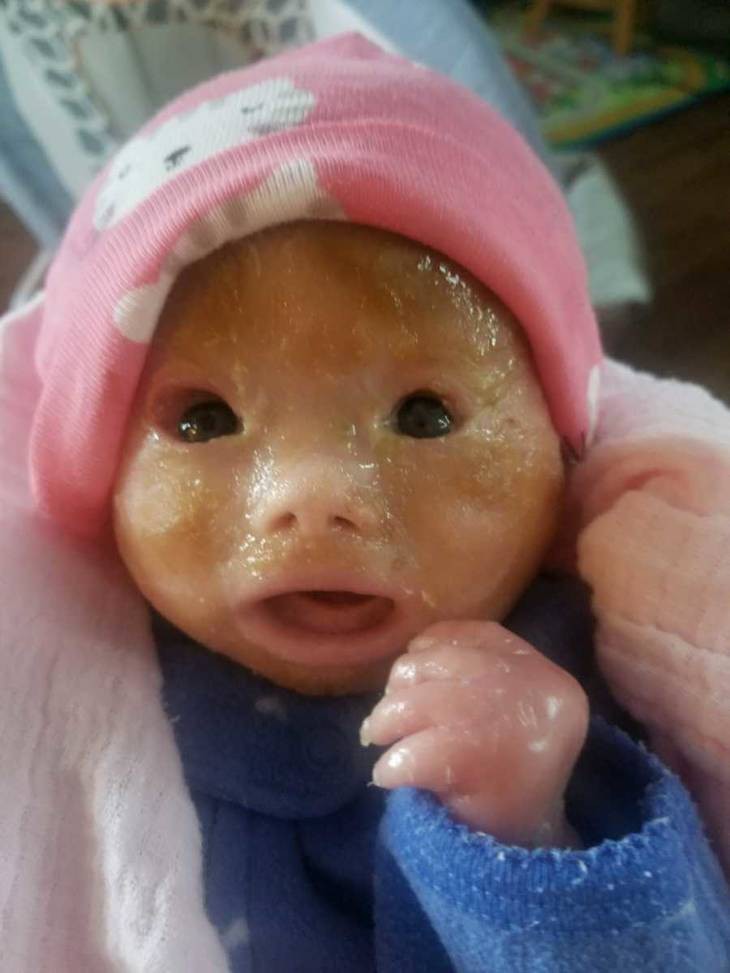 Mong đợi ngày con gái chào đời, mẹ lặng người khi lần đầu nhìn thấy khuôn mặt con - Ảnh 2. Mong đợi ngày con gái chào đời, mẹ lặng người khi lần đầu nhìn thấy khuôn mặt con - Ảnh 2.