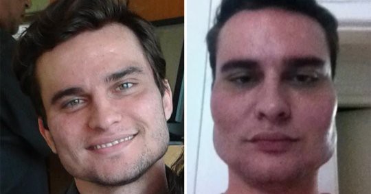 H&agrave;ng chục người bị biến dạng khu&ocirc;n mặt kh&ocirc;ng thể phục hồi, nhiều người bị trầm cảm v&igrave; sai lầm n&agrave;y của một b&aacute;c sĩ - Ảnh 2.