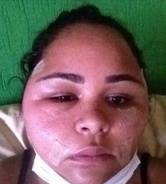 H&agrave;ng chục người bị biến dạng khu&ocirc;n mặt kh&ocirc;ng thể phục hồi, nhiều người bị trầm cảm v&igrave; sai lầm n&agrave;y của một b&aacute;c sĩ - Ảnh 4.