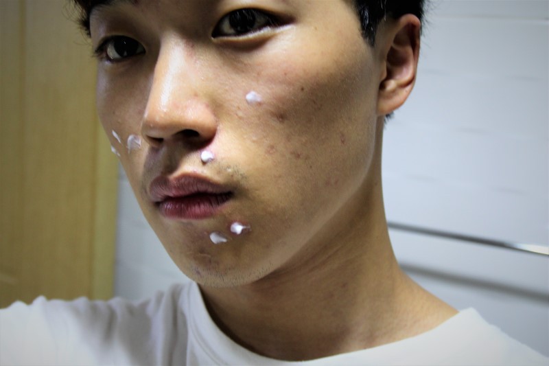 Nàng nào bị mụn thì đừng bỏ qua loại kem trị mụn của Nhật có giá chưa đến 200k này - Ảnh 6. Nàng nào bị mụn thì đừng bỏ qua loại kem trị mụn của Nhật có giá chưa đến 200k này - Ảnh 6.