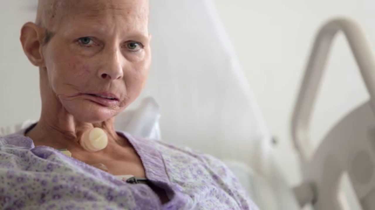 Hậu quả đáng sợ của việc hút thuốc qua lời kể của người trong cuộc khiến cho cả thế giới thức tỉnh: “Thuốc lá cướp đi cuộc đời tôi” - Ảnh 2. Hậu quả đáng sợ của việc hút thuốc qua lời kể của người trong cuộc khiến cho cả thế giới thức tỉnh: “Thuốc lá cướp đi cuộc đời tôi” - Ảnh 2.