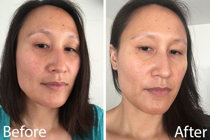 Ở tuổi 30, đầu tư vào toner chống lão hóa chẳng hề thừa mà còn cực tốt - Ảnh 6. Ở tuổi 30, đầu tư vào toner chống lão hóa chẳng hề thừa mà còn cực tốt - Ảnh 6.