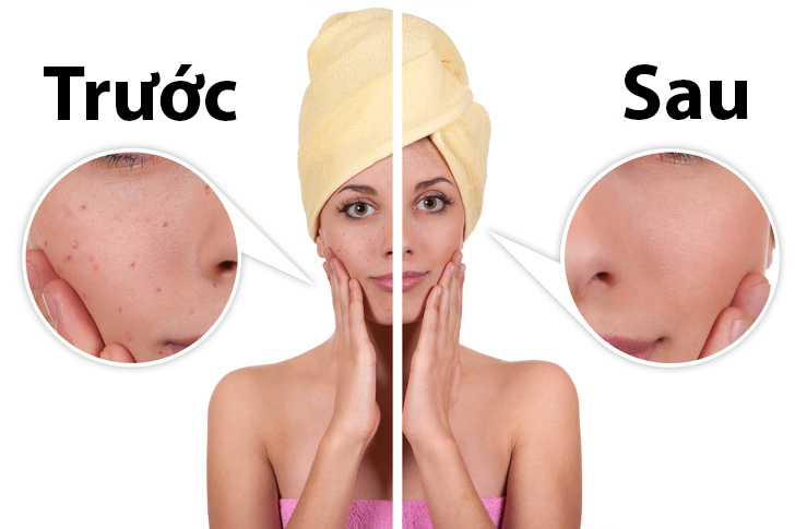 7 tác dụng làm đẹp diệu kỳ của khoai tây mà khi nói ra sẽ khiến khối chị em phải trầm trồ - Ảnh 3. 7 tác dụng làm đẹp diệu kỳ của khoai tây mà khi nói ra sẽ khiến khối chị em phải trầm trồ - Ảnh 3.